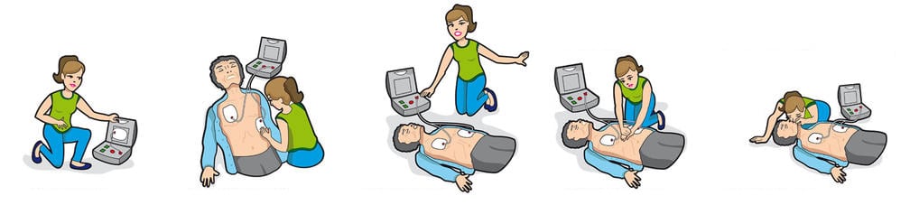 comment utiliser un defibrillateur